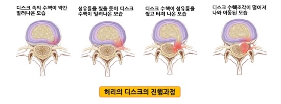 디스크2.jpg