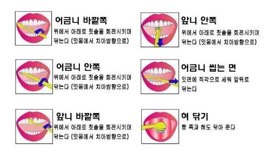 양치질2.jpg