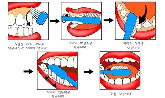 양치질3.jpg