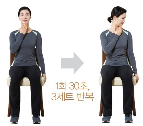 뇌혈관4.jpg