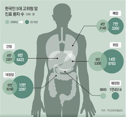 위암1.jpg