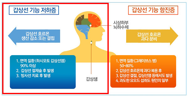 갑상선질환.jpg