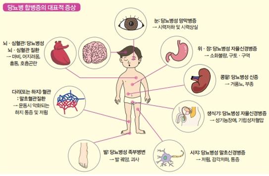 당뇨병의 대표적 증상.jpg
