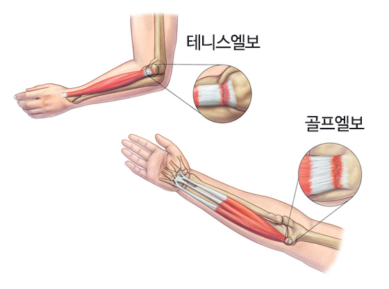 엘보우.jpg