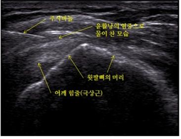 초3.jpg